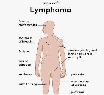 Symptoms of Lymphoma after Breast Cancer