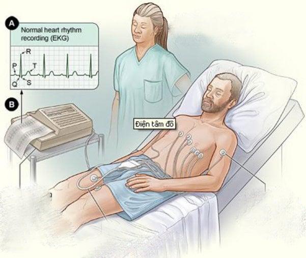 Ghi điện tim cấp cứu tại giường | Vinmec