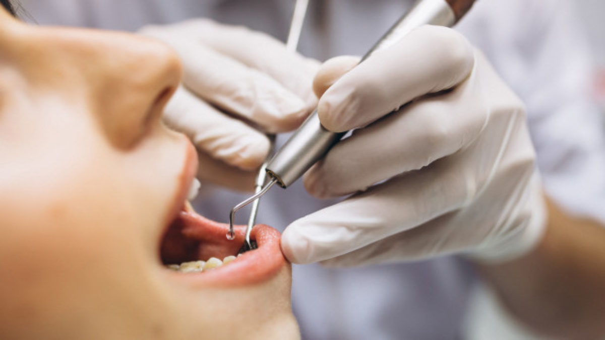 emergency dentistry in Vancouver