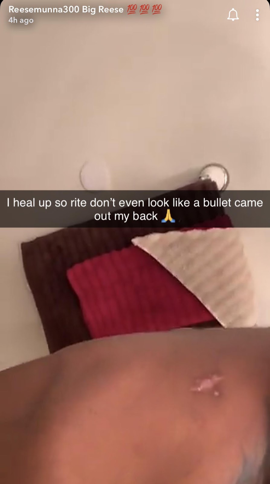 Lil Reese bullet wound on his back : r/Chiraqology