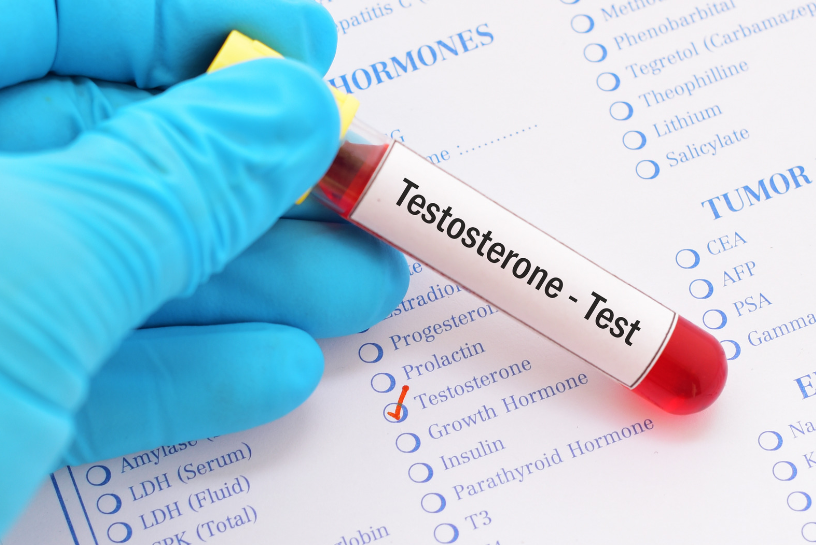The Link Between Low Testosterone and Low Sperm Count