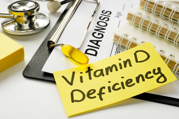 Vitamin Indeficiency