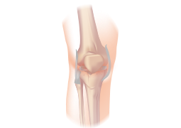 A close-up of a knee joint

Description automatically generated