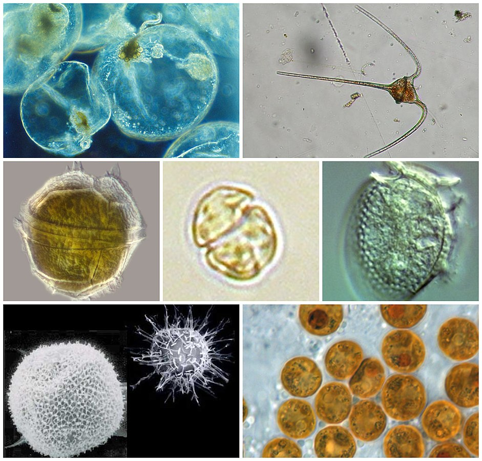 Different kinds of dinoflagellates as seen under a microscope. Some appear more granular or structural while others are more rounded.