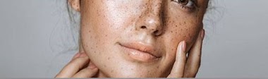 How Do You Get Rid Of Pigmentation Around Your Mouth?