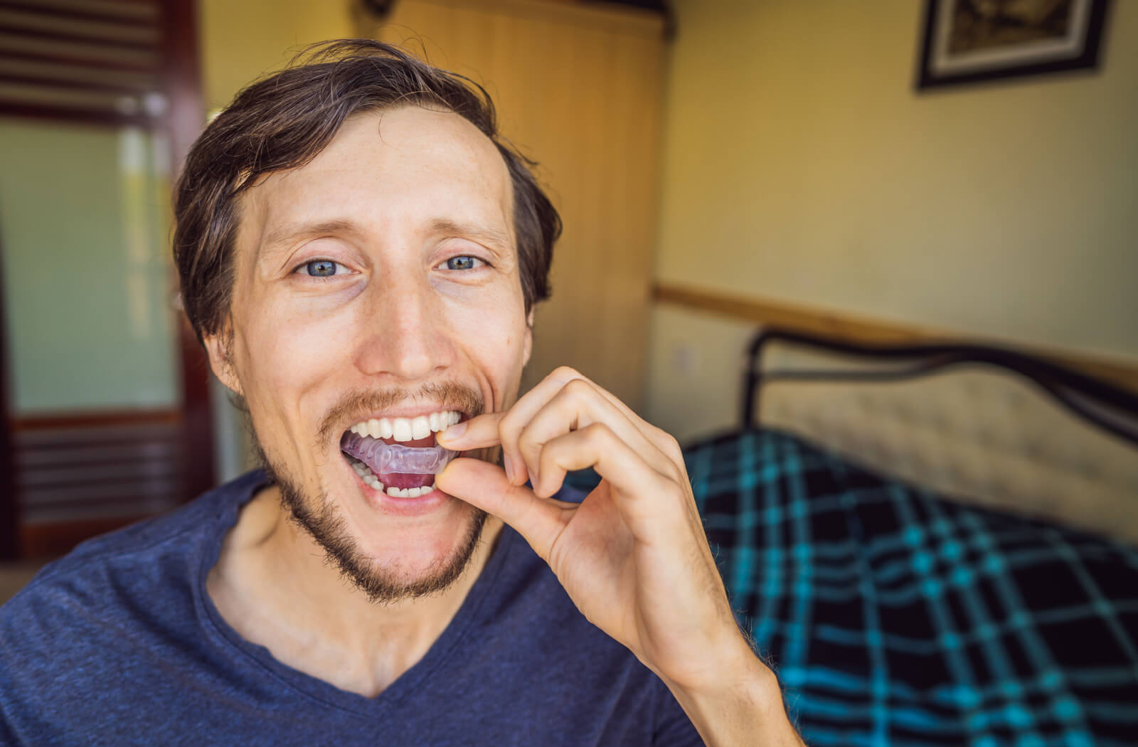 A man putting on a mouthguard to protect his teeth from grinding.