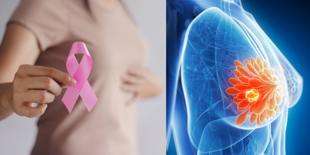 Breast Health and Cancer Prevention