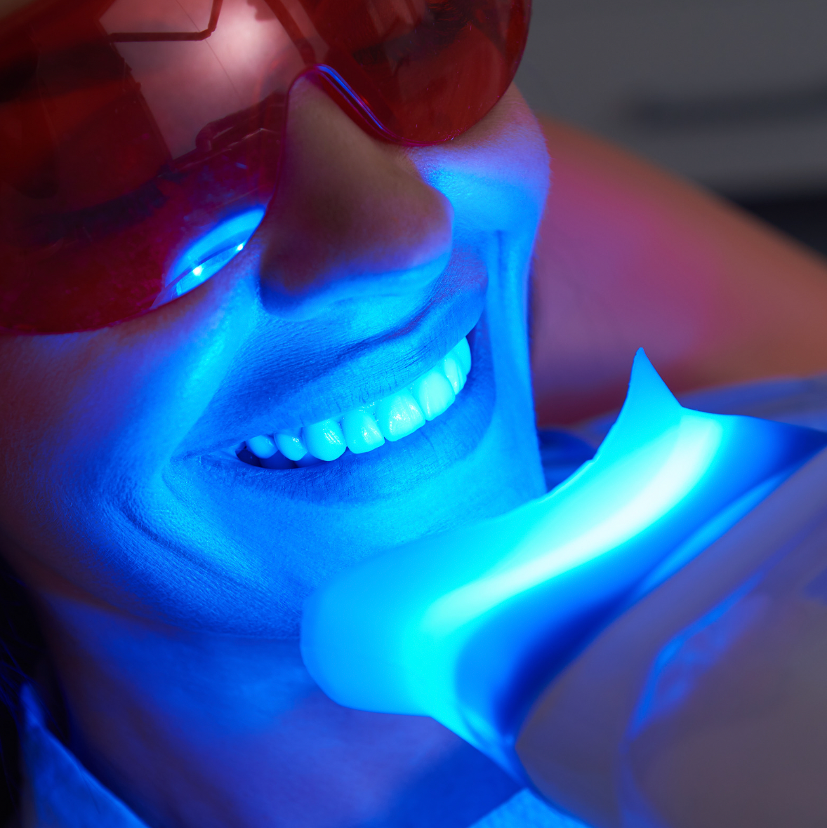 Teeth whitening