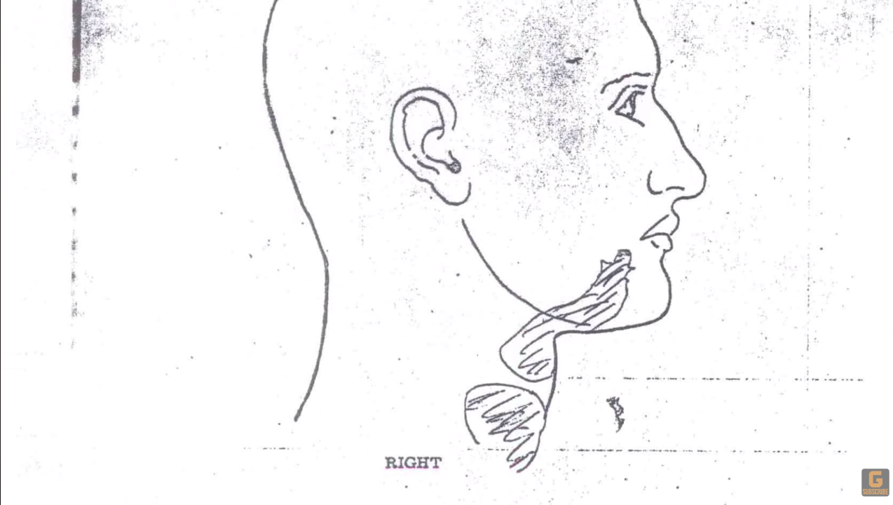 A drawing of a person's face

Description automatically generated