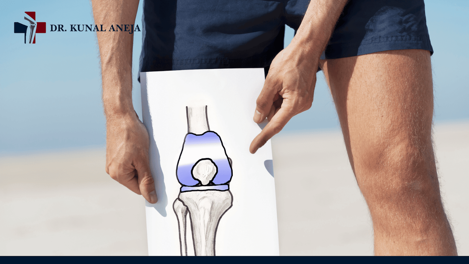 knee replacement surgeon in delhi