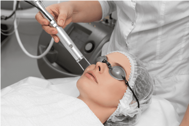 Trẻ hóa da bằng laser là phương pháp giúp cải thiện làn da tốt hơn