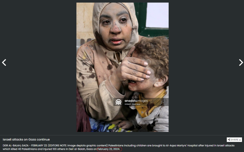 أم فلسطينية تغطي عين ابنها المصاب أثناء تلقيه العلاج في مستشفى شهداء الأقصى