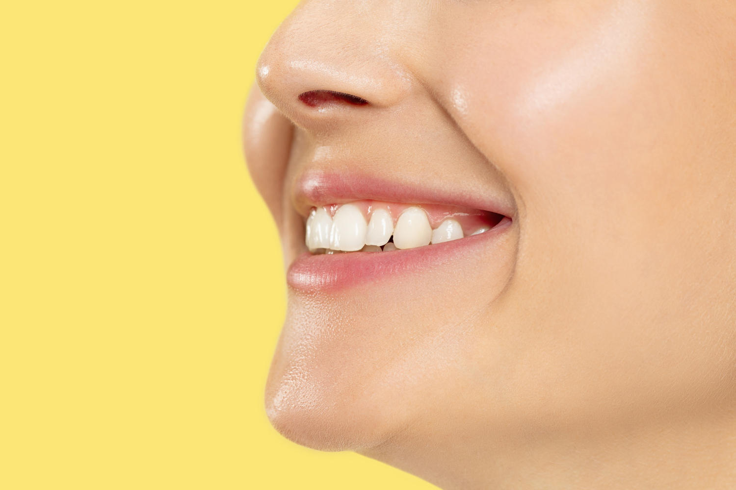 Răng sứ HT smile là một trong những dòng răng sứ cao cấp được nhiều khách hàng lựa chọn