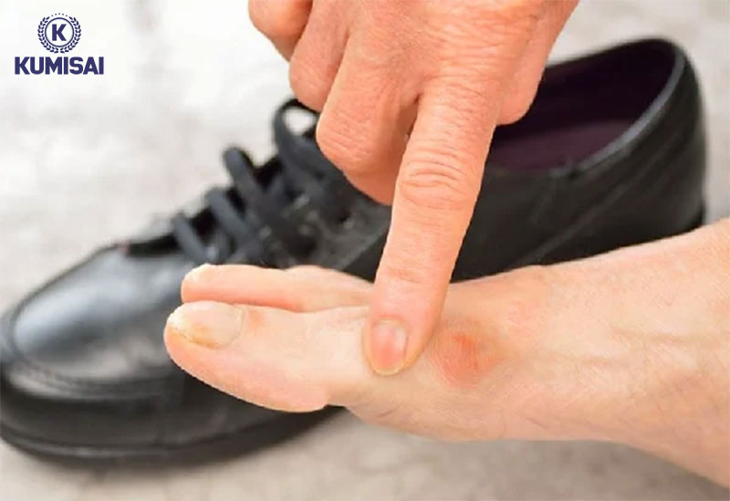 Đi giày da bị cứng gây cảm giác khó chịu cho người đeo khi di chuyển