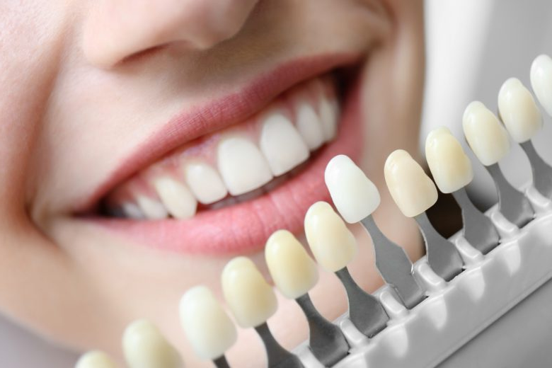 cosmetic dentistry in Vancouver