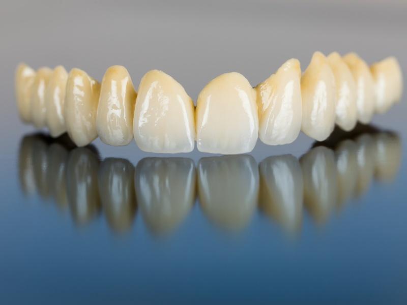 Răng sứ Zirconia và một số thông tin quan trọng