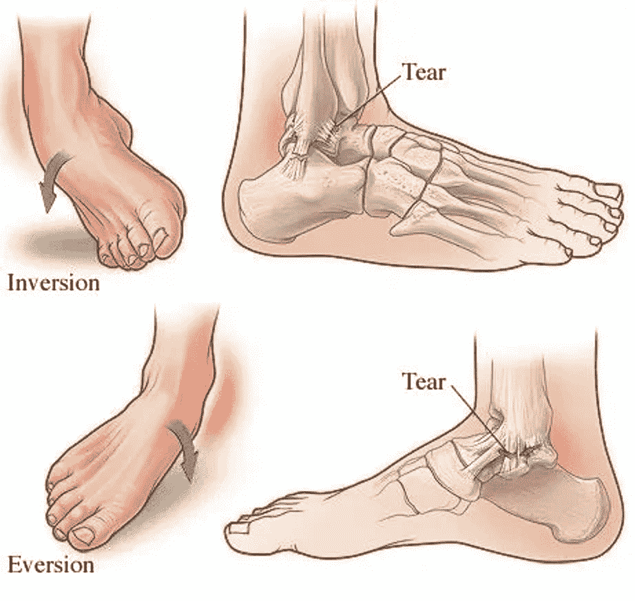 Cách điều trị