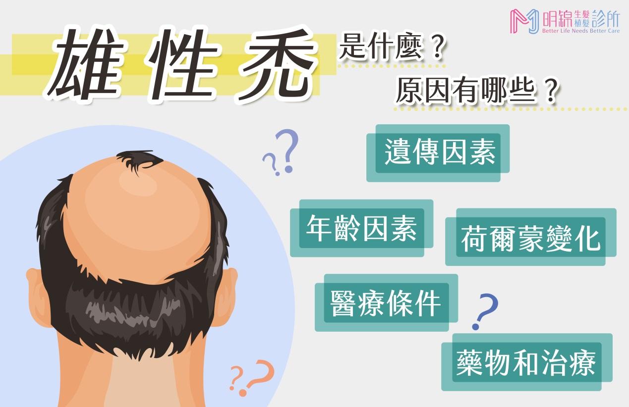 雄性禿是什麼？原因有哪些