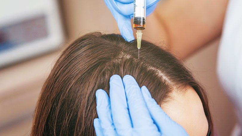 Genetic Hair Loss Treatment
