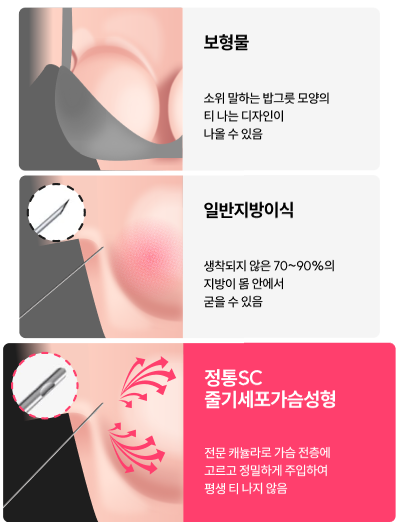 캐뉼라미세.png