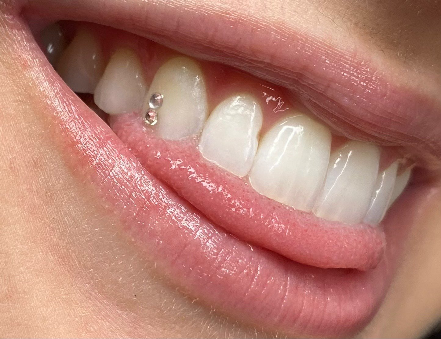 Close up view of  a dentition wearing tooth gems