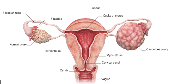  Ovarian Cancer After Pregnancy