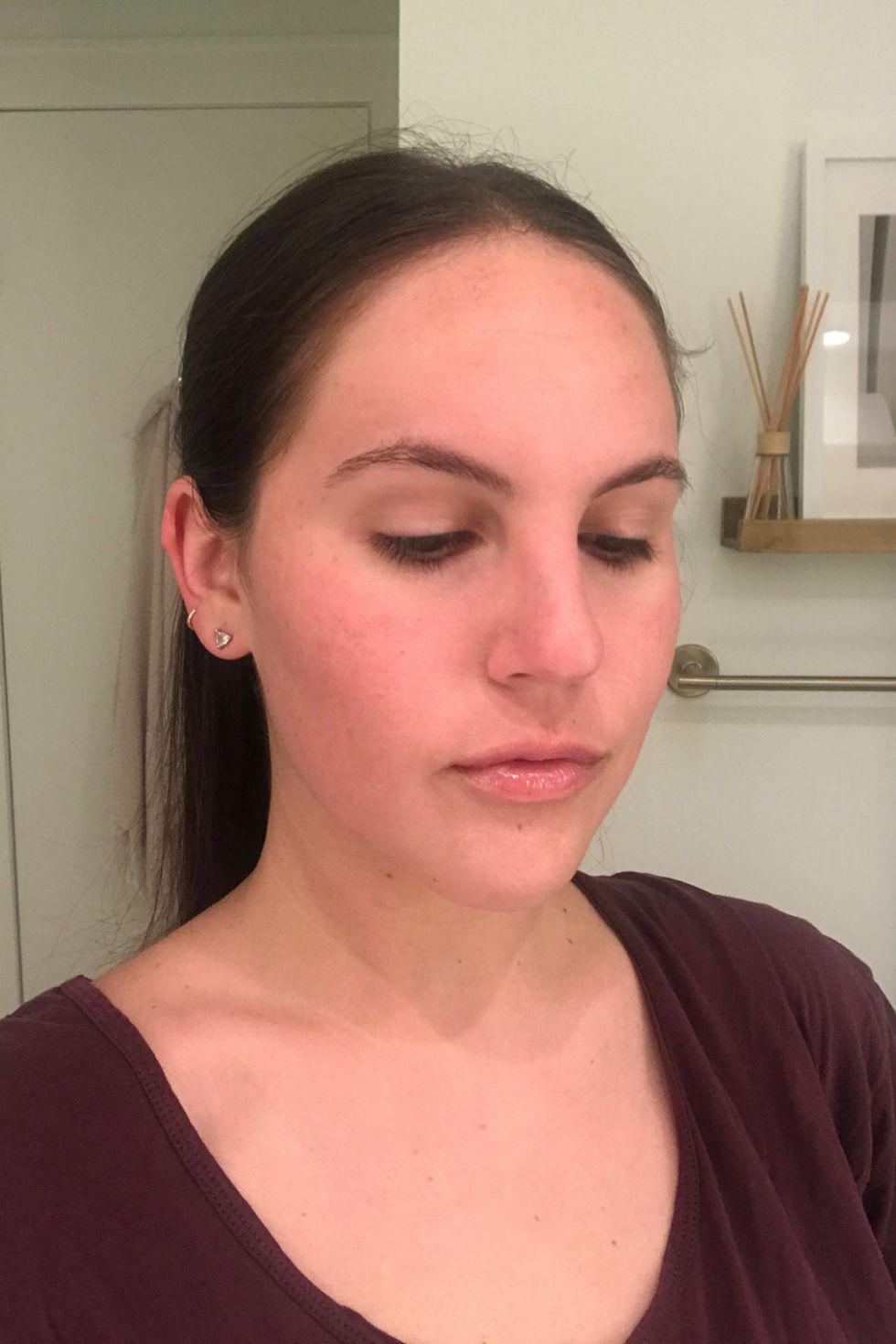 3 Weeks After Vampire Facial