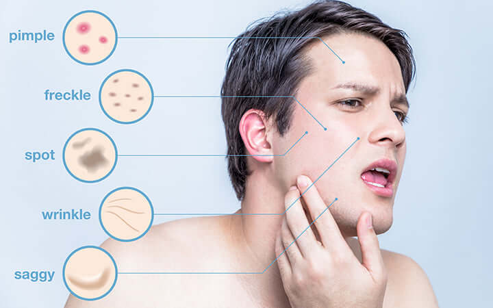 Vì sao nam giới bị kích ứng da?