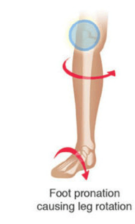 Knee Pain And Foot Mechanics | CHARM