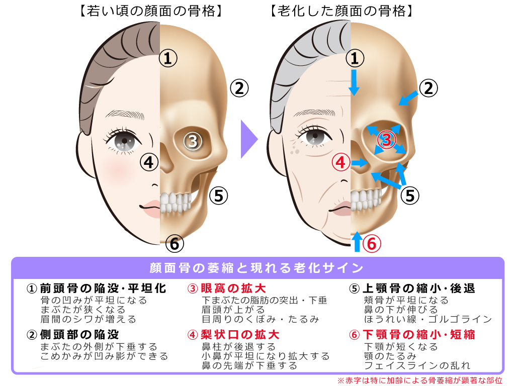 顔面骨の萎縮と現れる加齢サイン