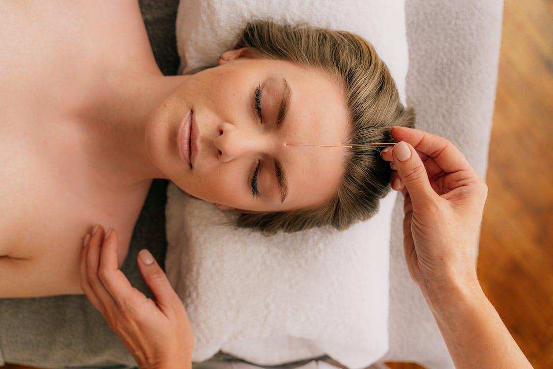 Free Woman Receiving an Acupuncture Treatment Stock Photo