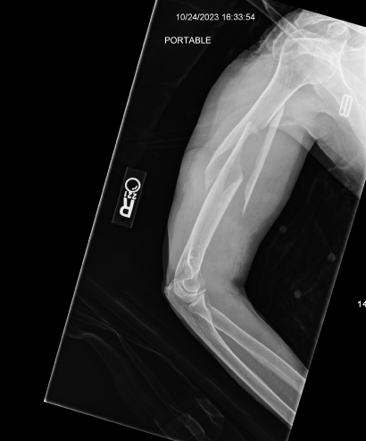 X-ray of a human arm

Description automatically generated