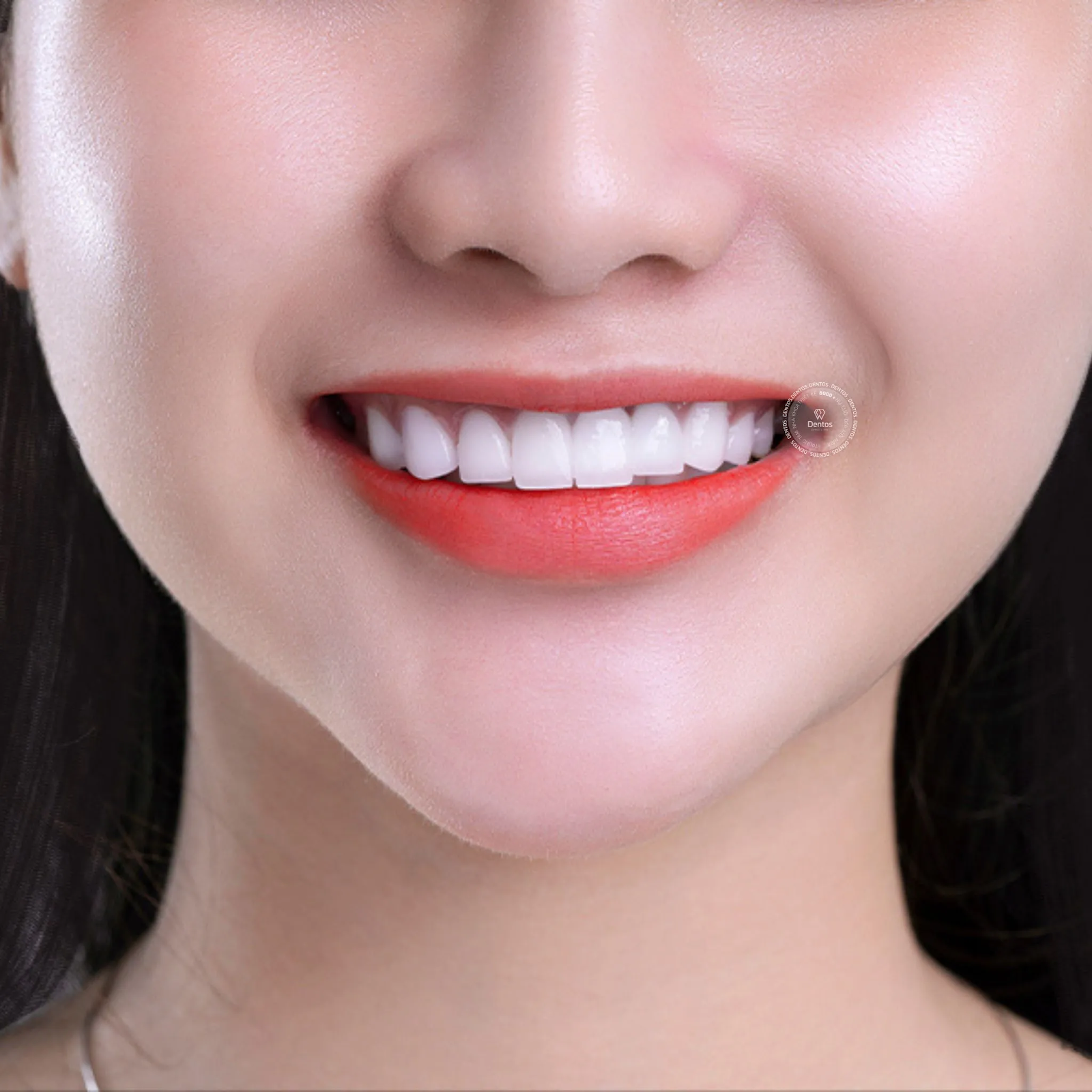 Tìm hiểu về răng sứ Zirconia - Khi nào cần bọc? Nên bọc loại nào? Có bị đau không?