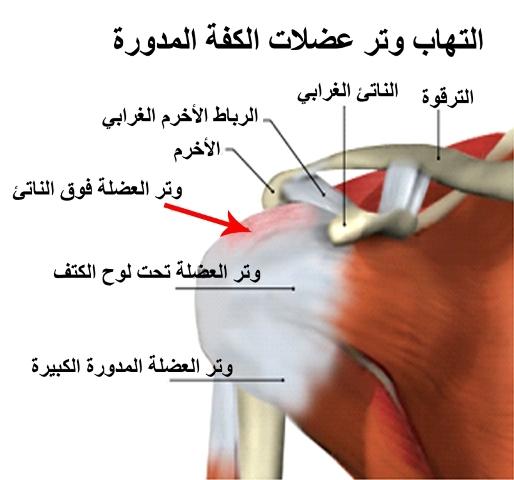 E:\Documents and Settings\USER\Desktop\كبار السن\التهاب وتر الكفة المدورة.jpg