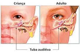 Otites: porque as crianças são as maiores vítimas?