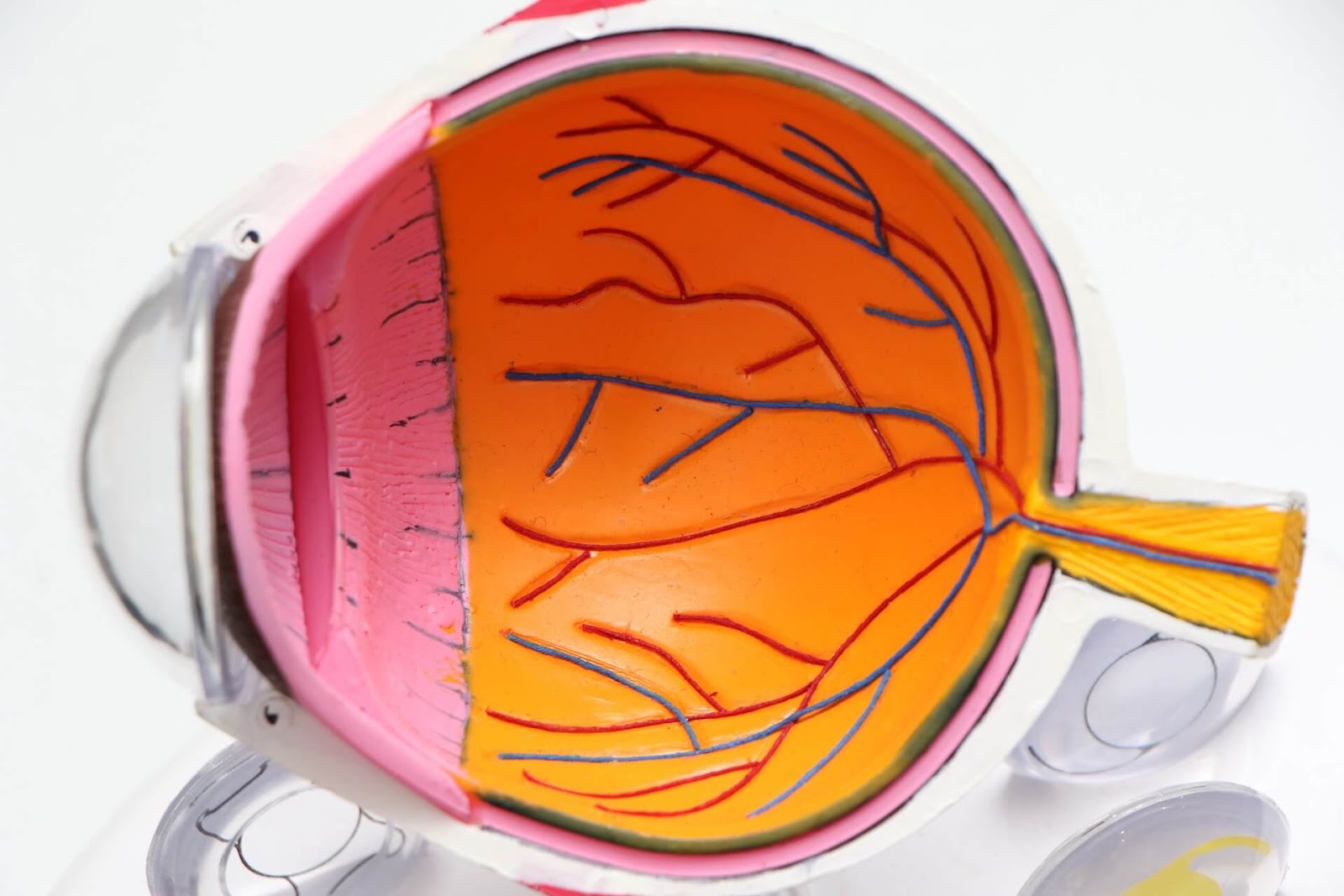 Episclerita nodulară, anatomia ochiului și care structură a acestuia este afectată în episclerită, optimarvisioncare.ro