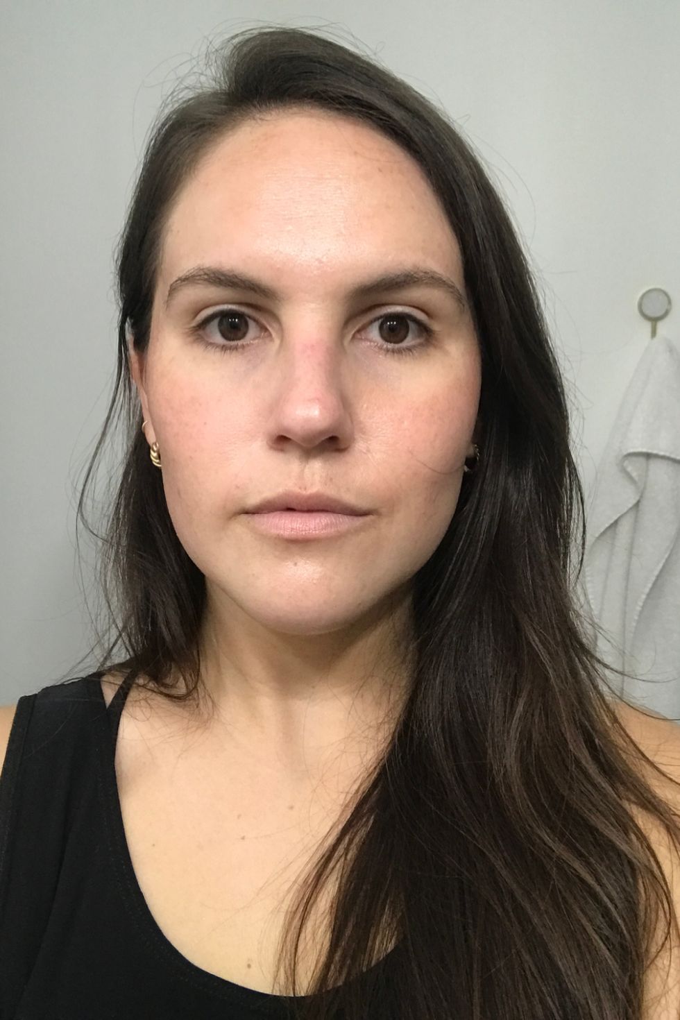 2 Weeks After Vampire Facial