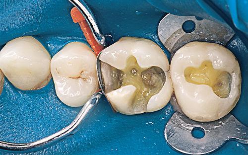 cosmetic dentistry in Toronto