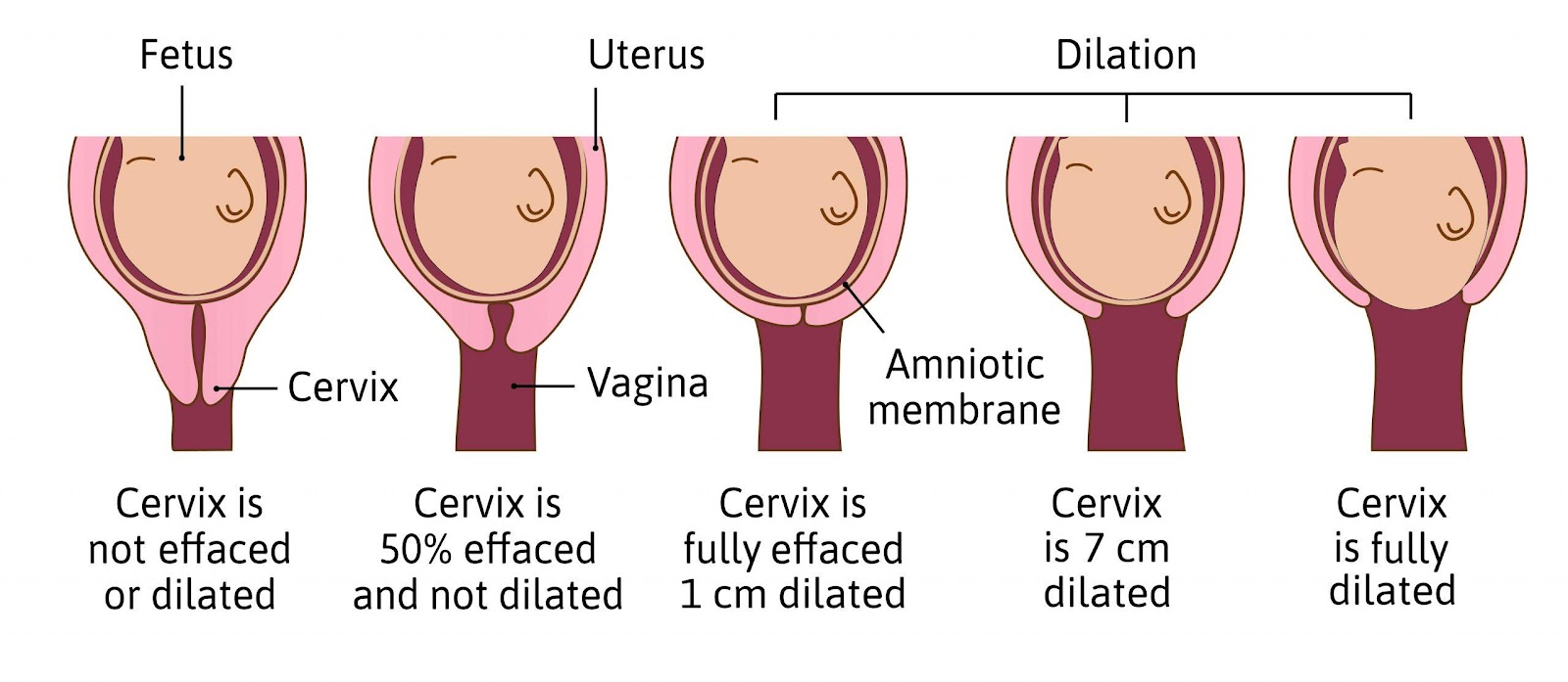 What is Dilation in Pregnancy? - American Pregnancy Association