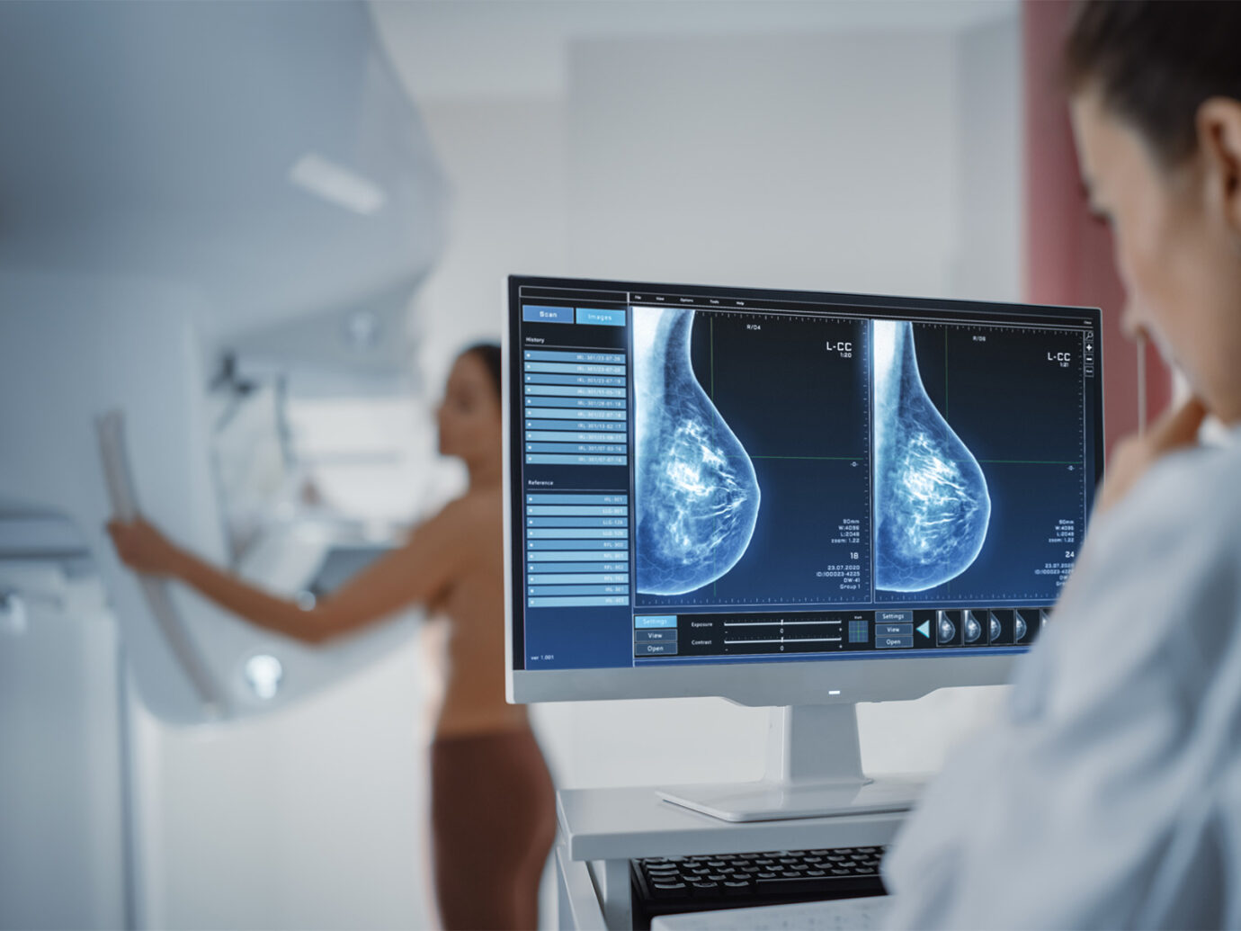 a radiologist using ProFound AI Breast Cancer Health Suite for reading mamogram 