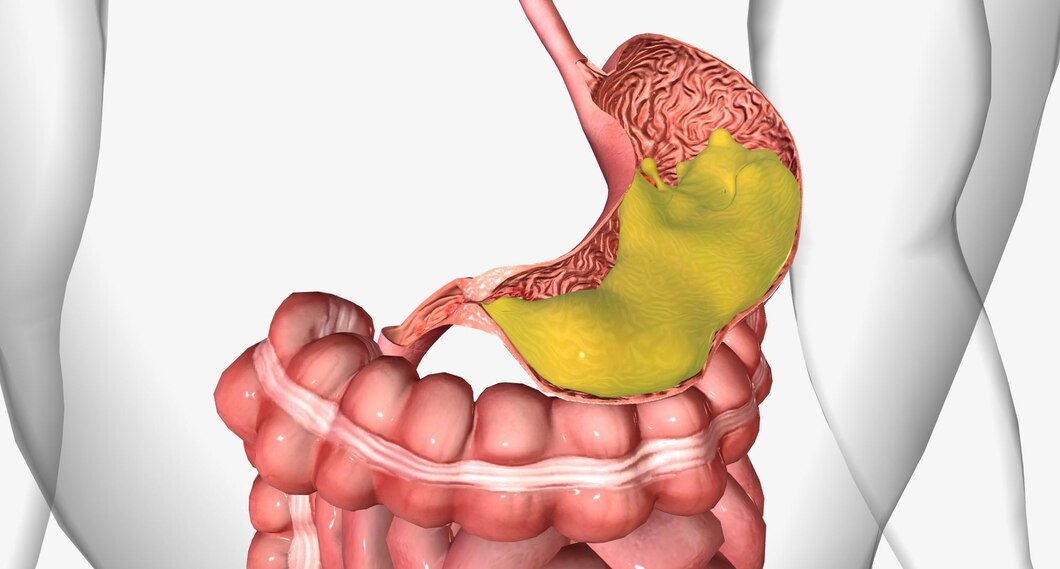 Stomach Cancer in Young Adults