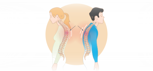 Illustration of common posture issues