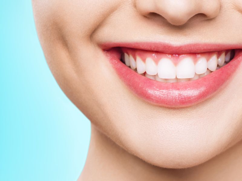 odontologia estética o que é lentes de contato dental