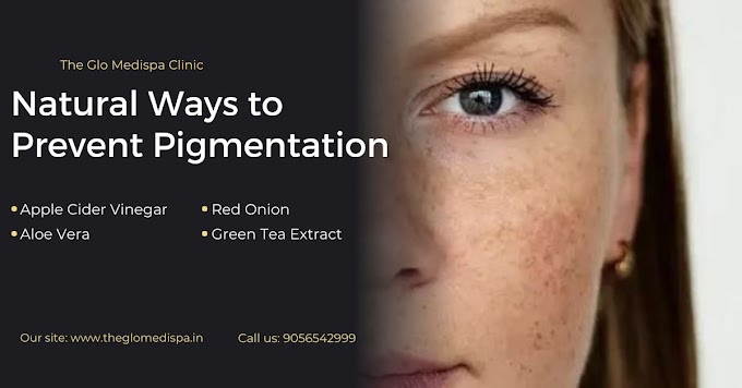 Top 4 Natural Ways to Prevent Pigmentation 