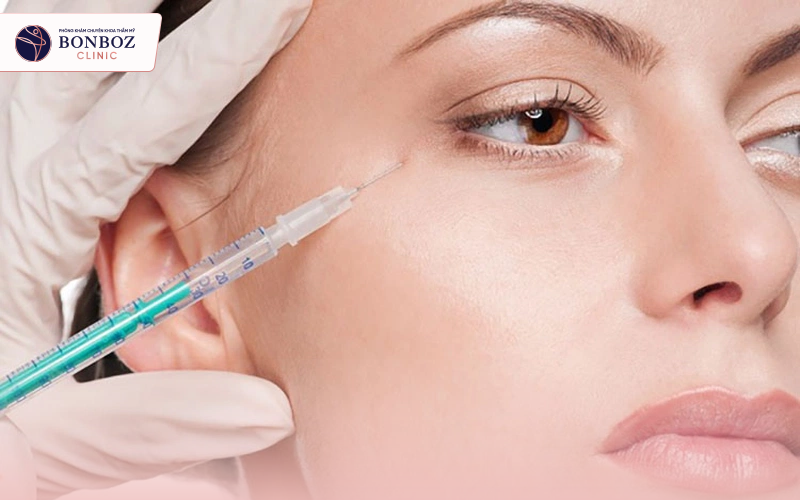 Tiêm filler quầng thâm mắt