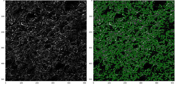 Figure 2: Example of input image (at left) and segmentation of Tyrosine Hydroxylase objects by CellProfiler (at right).