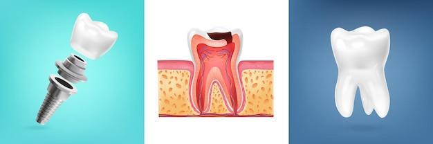 Realistic design with human tooth anatomy illustration