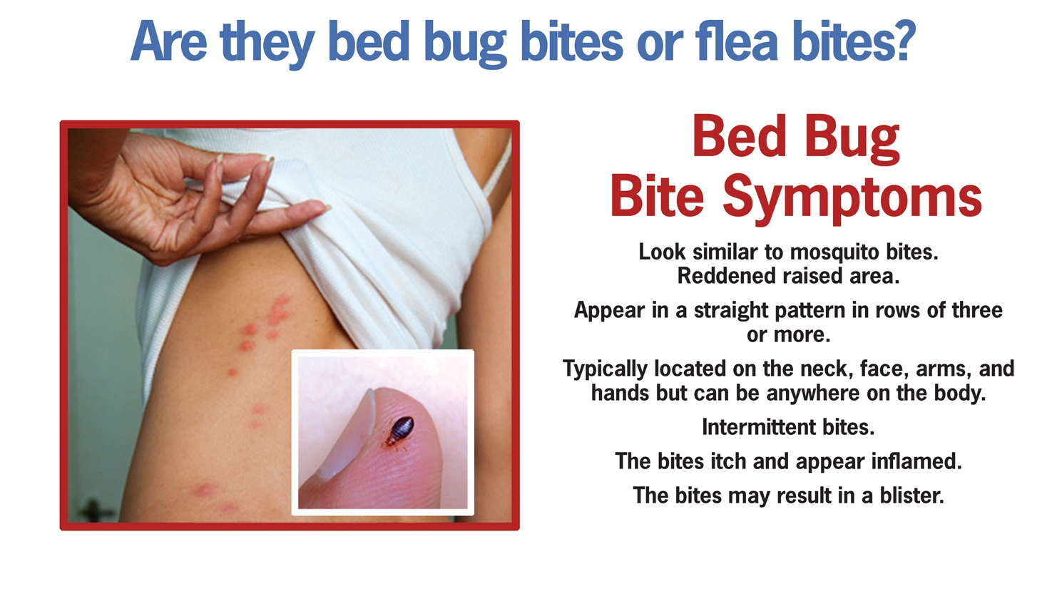 itchy-insomniacs-the-truth-about-bed-bug-and-flea-bites-leedsjournal