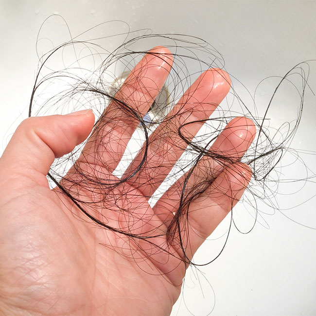 Hair Fall After Shower: Tips to Prevent Excess Loss