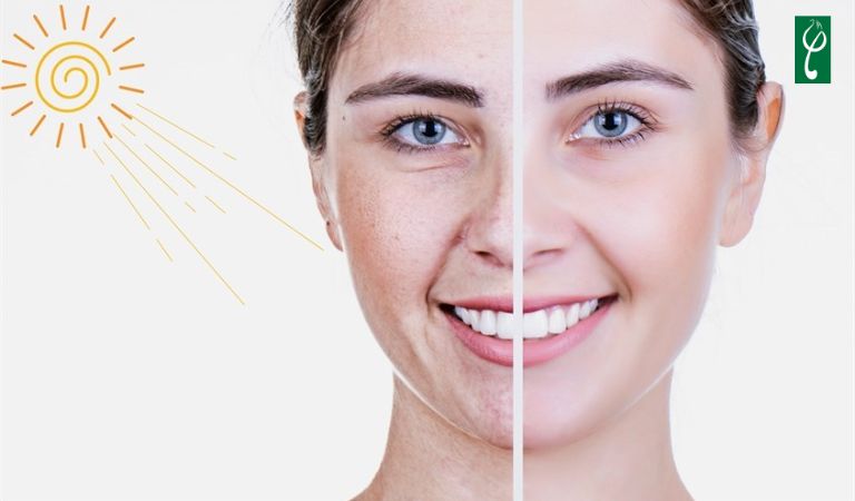 Sử dụng kem chống nắng là bước quan trọng khi skincare